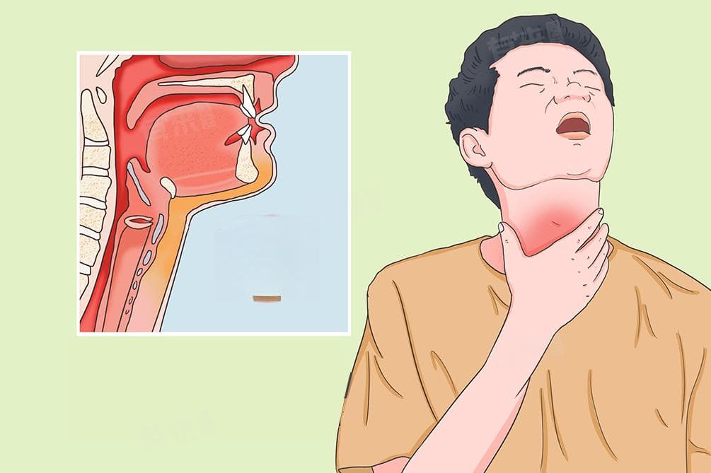 失声快速恢复十大方法
