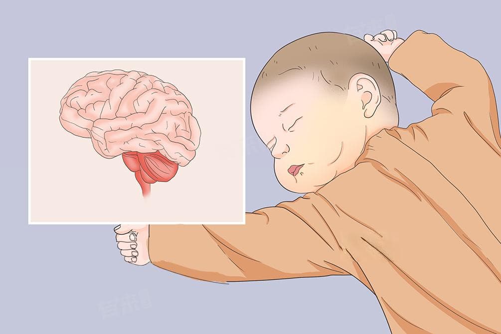 新生儿胆红素偏高的原因及危害