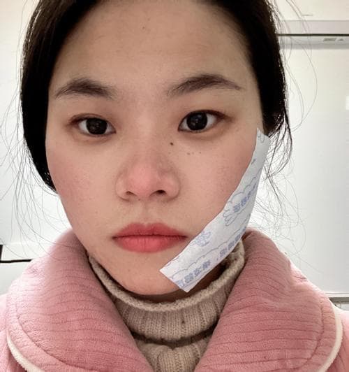 智齿难拔的原因及处理方法（揭秘智齿难拔的危害与挑战，探究最佳治疗方法）