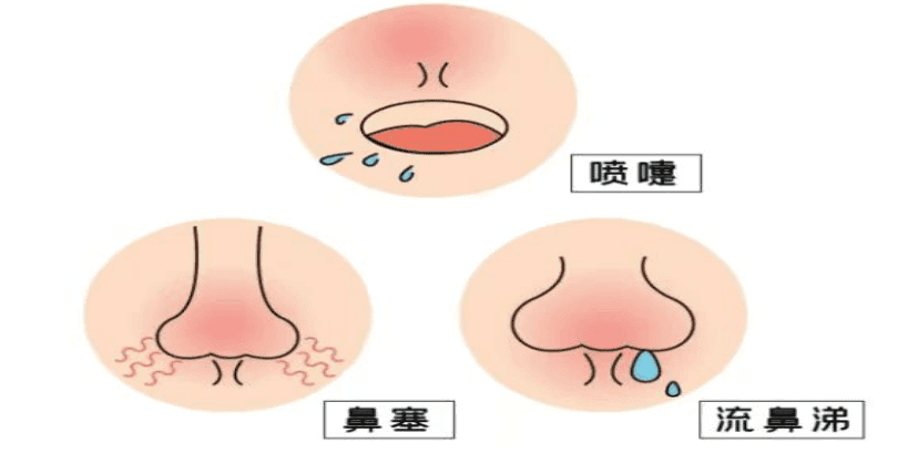 如何预防季节性过敏？