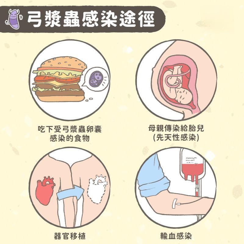认识弓浆虫感染症！孕妇必看弓浆虫感染途径、预防守则