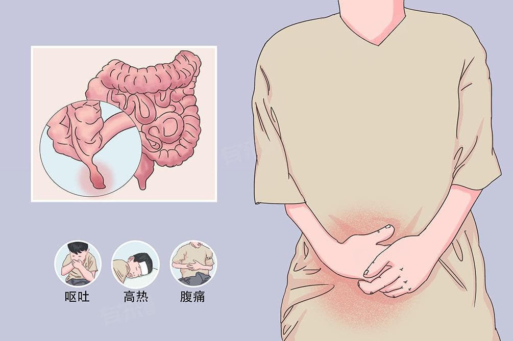 儿童急性阑尾炎的症状