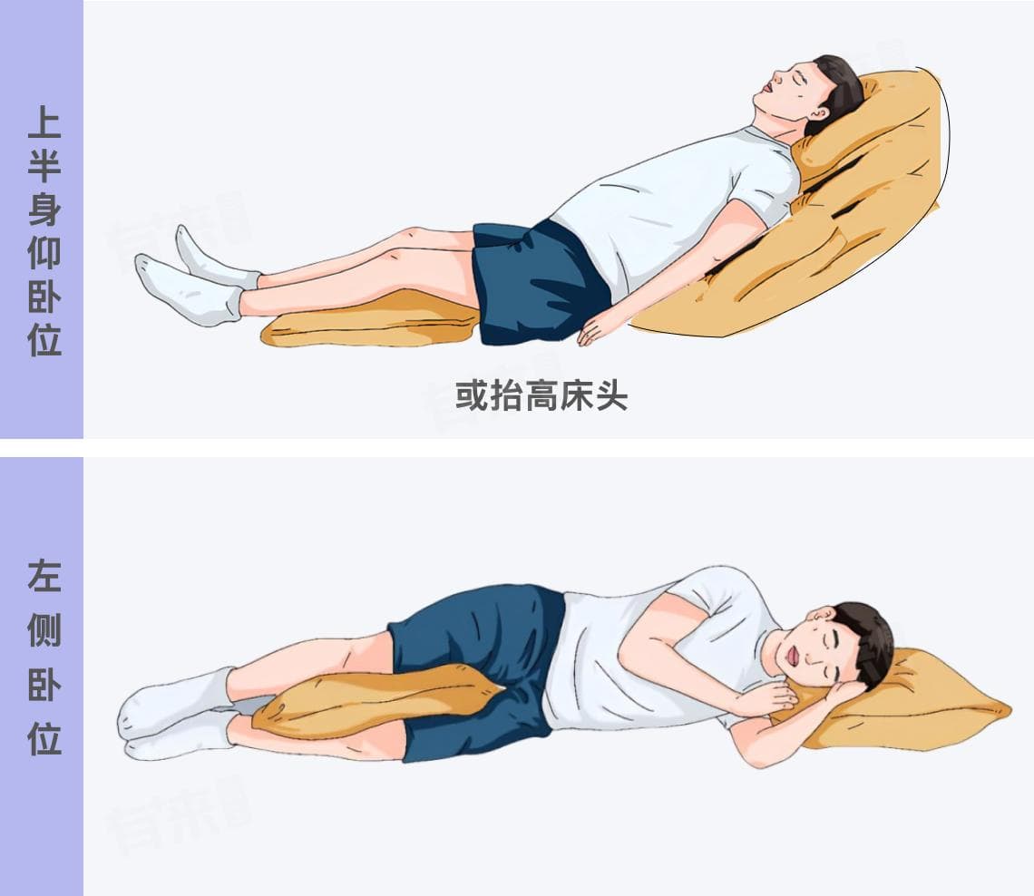反流性食管炎睡觉的正确姿势