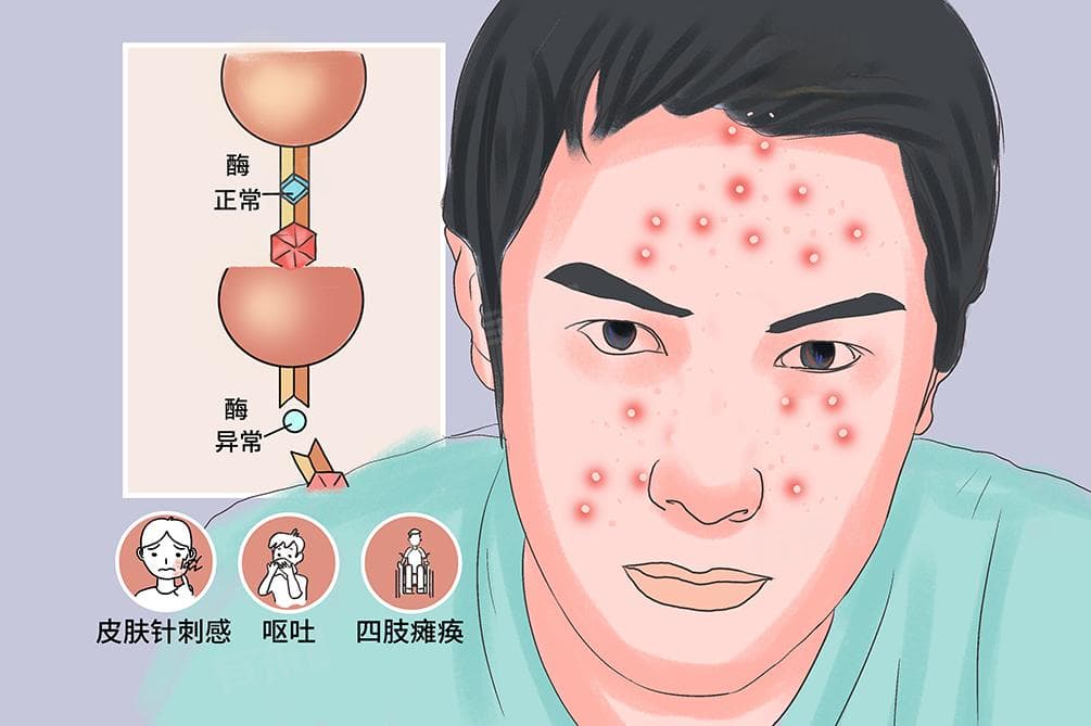 卟啉症：一种罕见的代谢性疾病