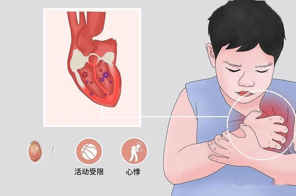 达安科普，生化检验指标心梗三项到底有多牛？