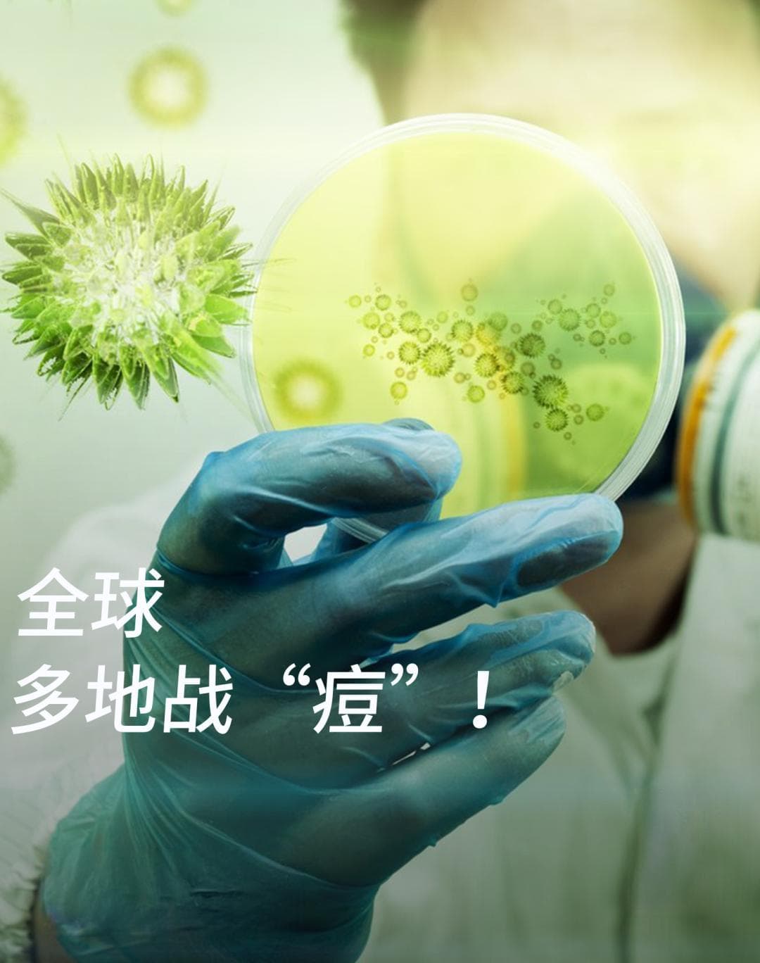 猴痘病毒已致近2万人感染，目前国内没有疫苗