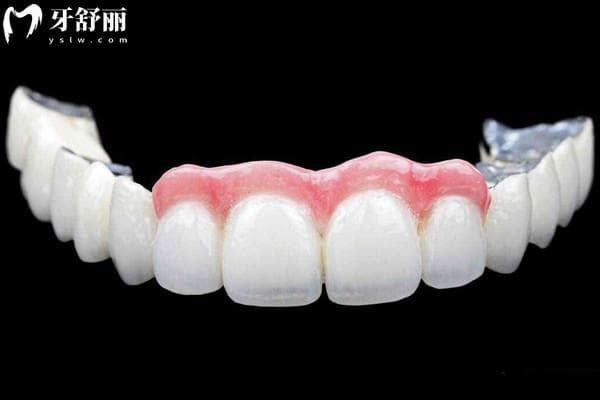 爱尔创全瓷牙冠与进口品牌的差别在哪？品牌/效果/价格等皆不同