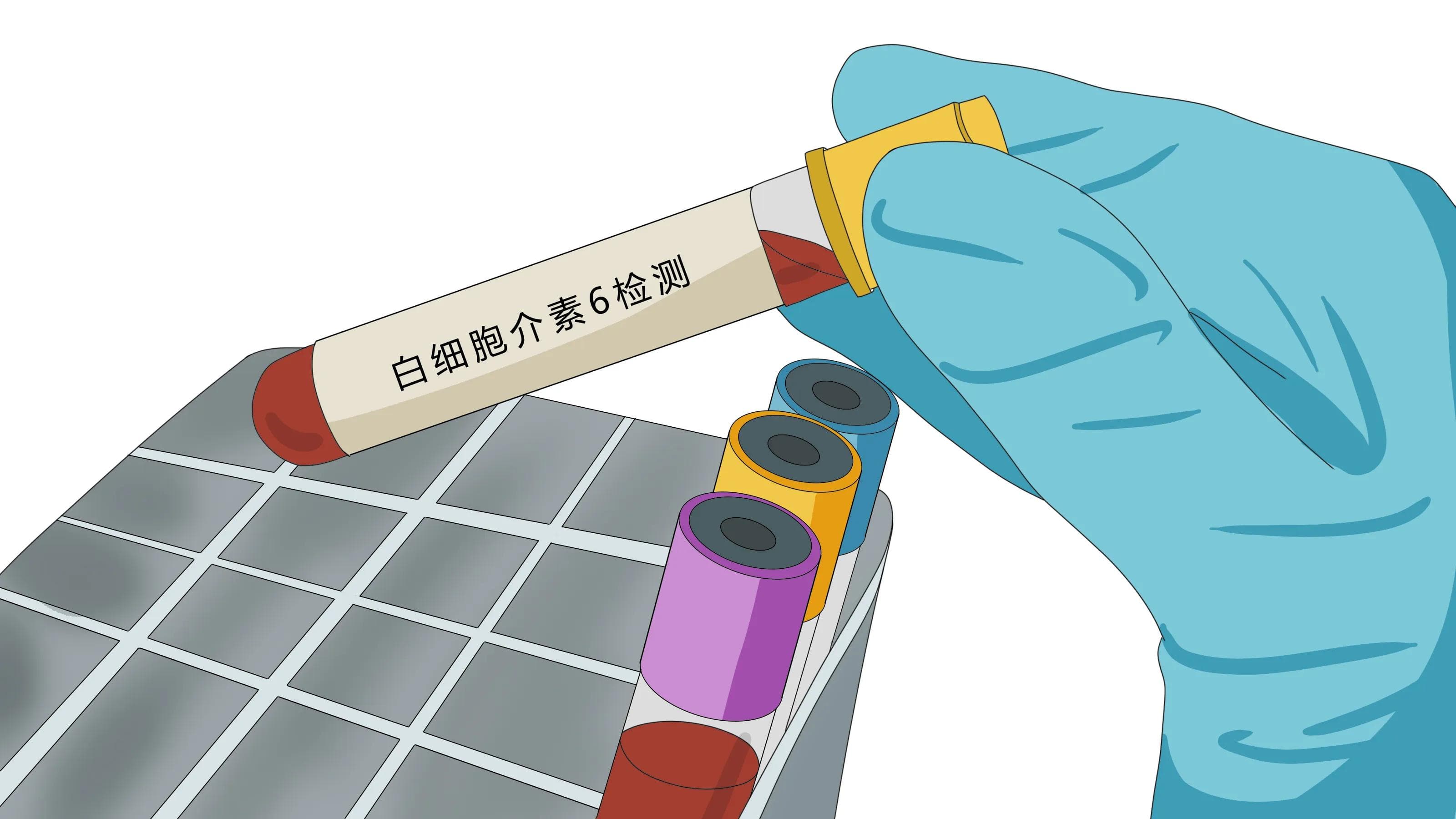 白细胞介素-6偏高说明什么