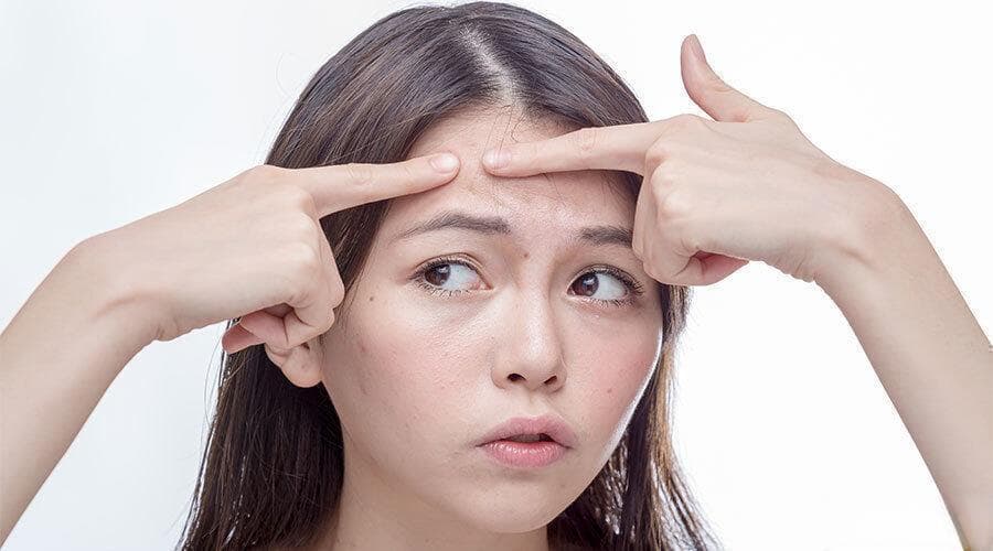 脸上有了痘印痘坑，好难看！我该怎么办？