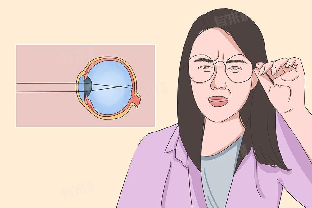 视力矫正治疗：非手术与手术方法全解析