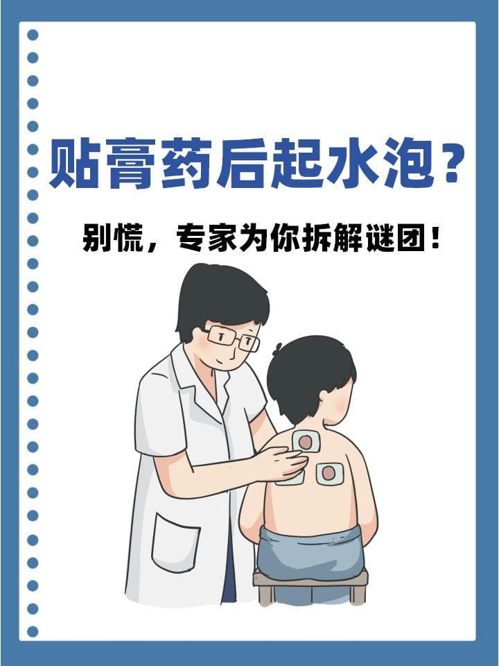 贴膏药后起水泡？别慌，专家为你拆解谜团！