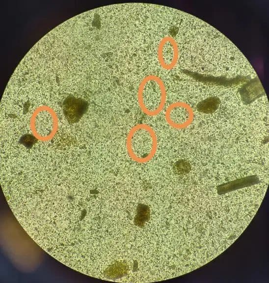 人芽囊原虫感染，你知多少？