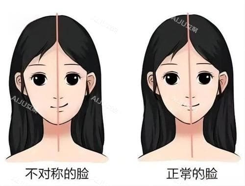 科普正颌手术常见切口位置：口外|口内|面侧三个位置，医生更推荐口更隐蔽的内切口