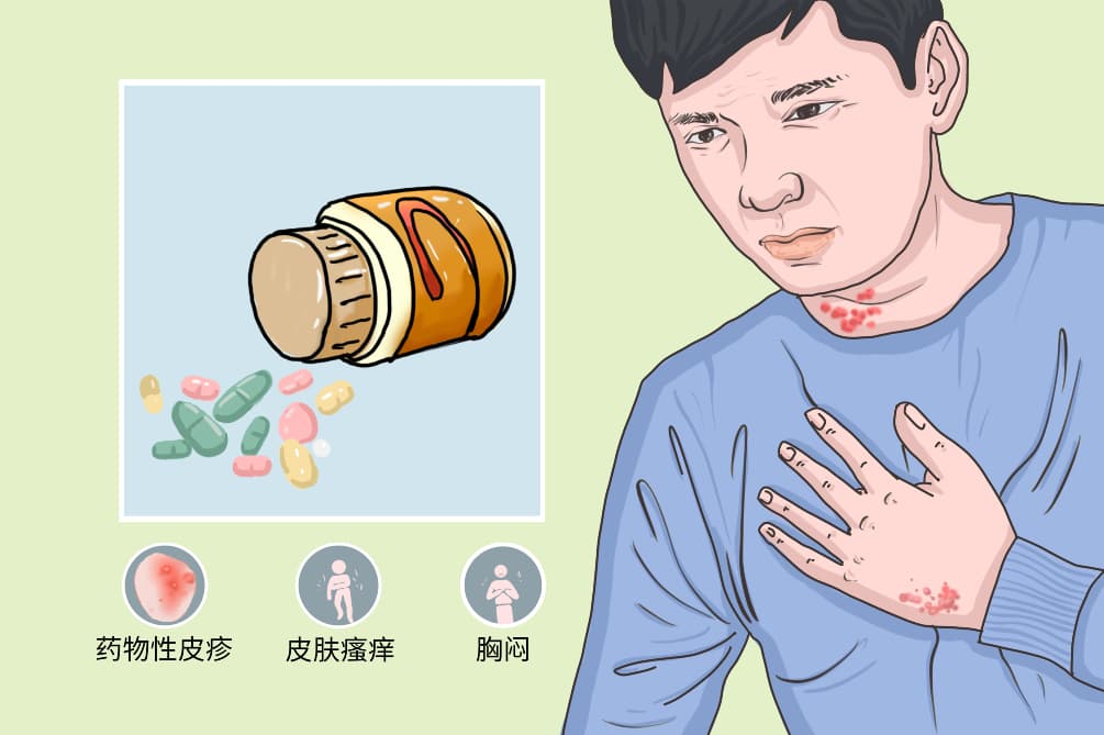 普瑞巴林和甲钴胺能一起吃吗