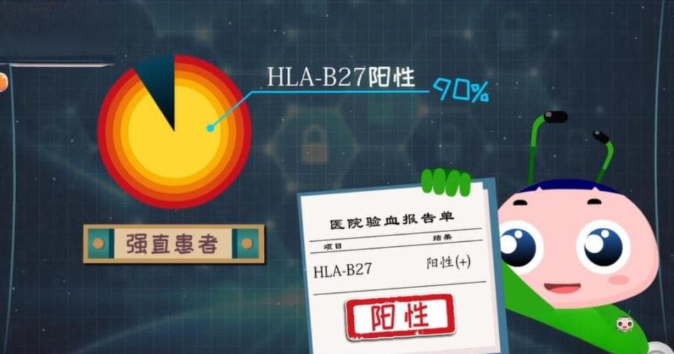 得了强直性脊柱炎，各个阶段应该检查哪些项目？