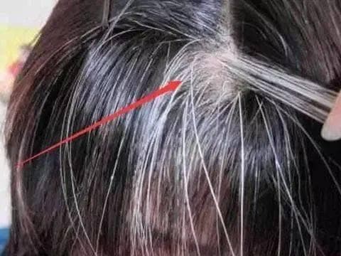 前额白发是脾胃虚，两鬓斑白肝火旺：白发背后的健康密码