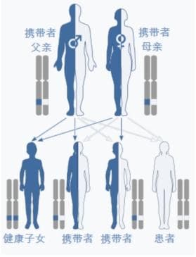 【产科宝典】建议所有夫妻都要做的一个检查——单基因遗传病携带者筛查