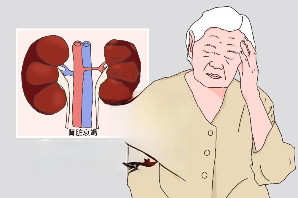 肾性脑病：尿毒症引发的神经系统病变