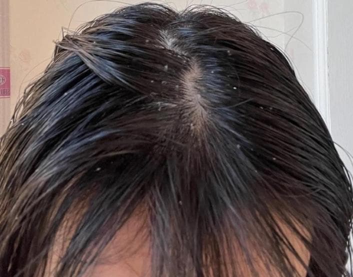 洗发水里的月桂醇是什么？一文读懂其利弊与替代选择