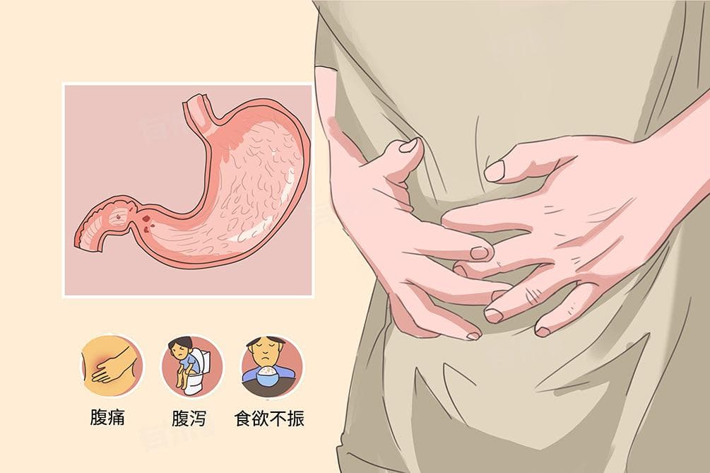 胃泌素17偏高能自愈吗