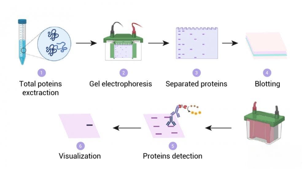 实验操作 | Western Blot 实验步骤 + 不可忽视的小细节（全）