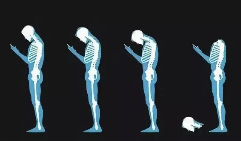 张仲景《伤寒论》中的葛根汤：治疗颈椎病的特效方