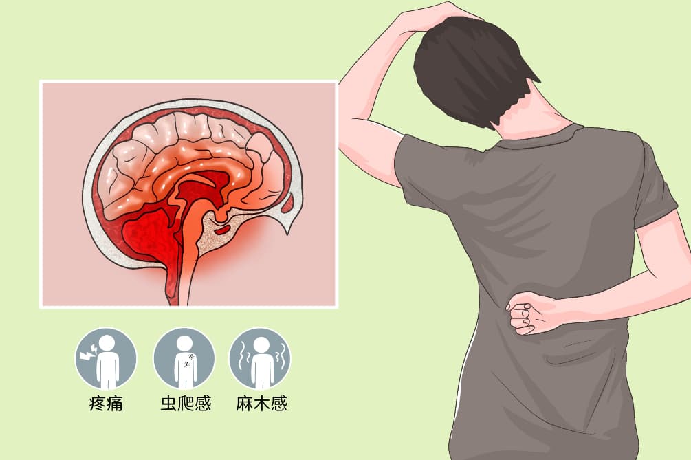 神经痛：症状、诊断与治疗全解析