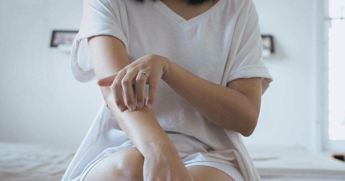 牛皮癣：症状、治疗与预防