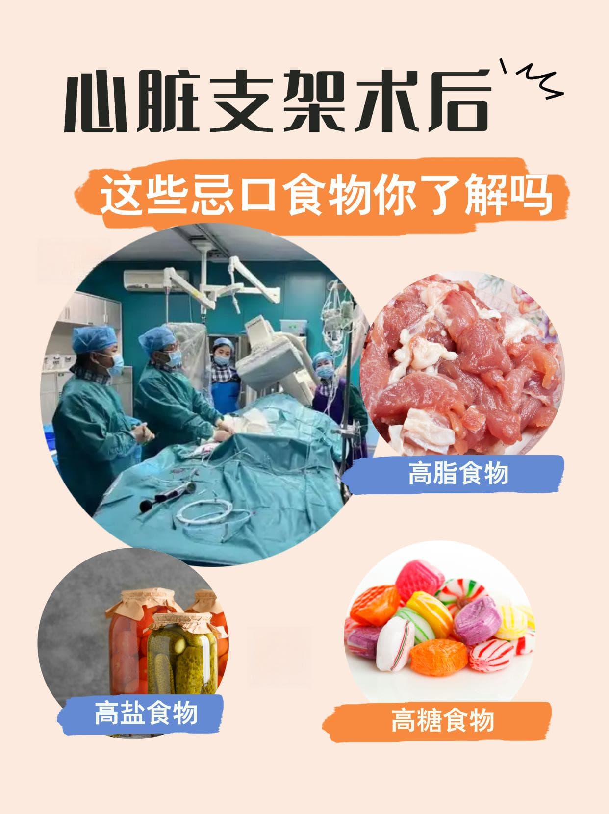 心脏支架术后，这些忌口食物你了解吗？