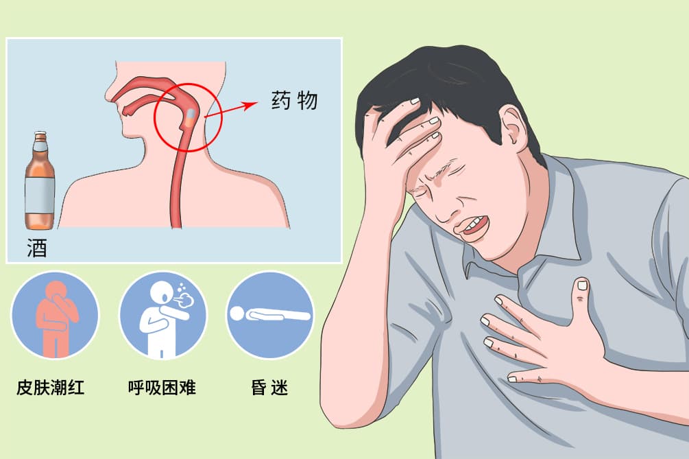双硫仑样反应：定义、症状、诊断与预防全解析