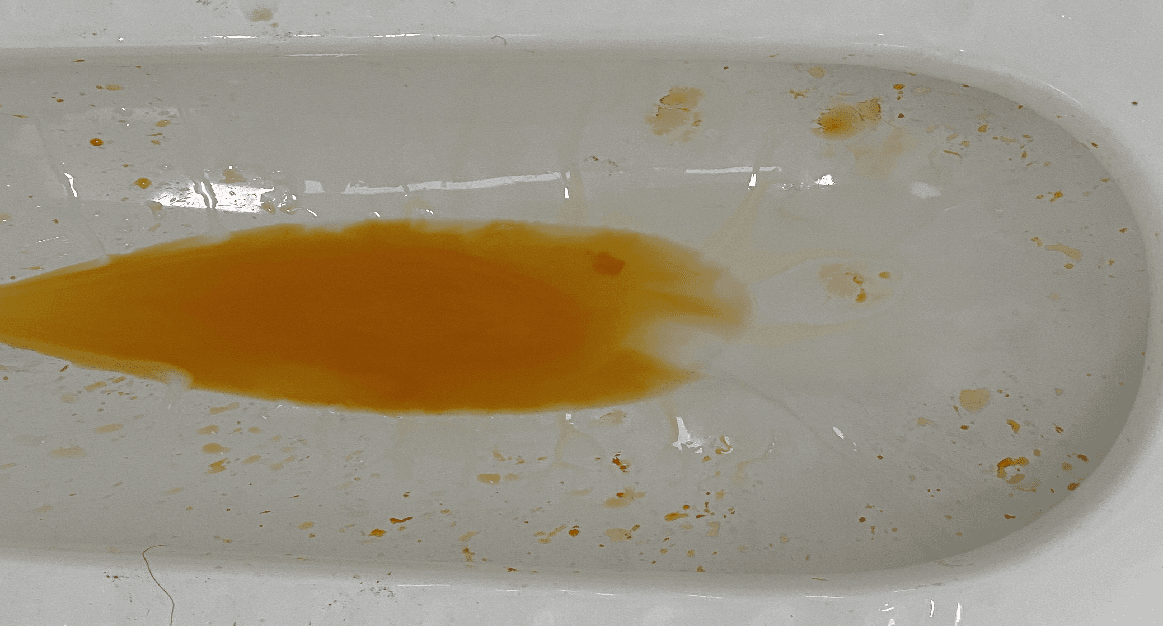 了解结核药常见副作用，不要见“色”恐慌！