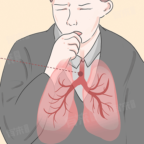 抽烟咳嗽是什么原因