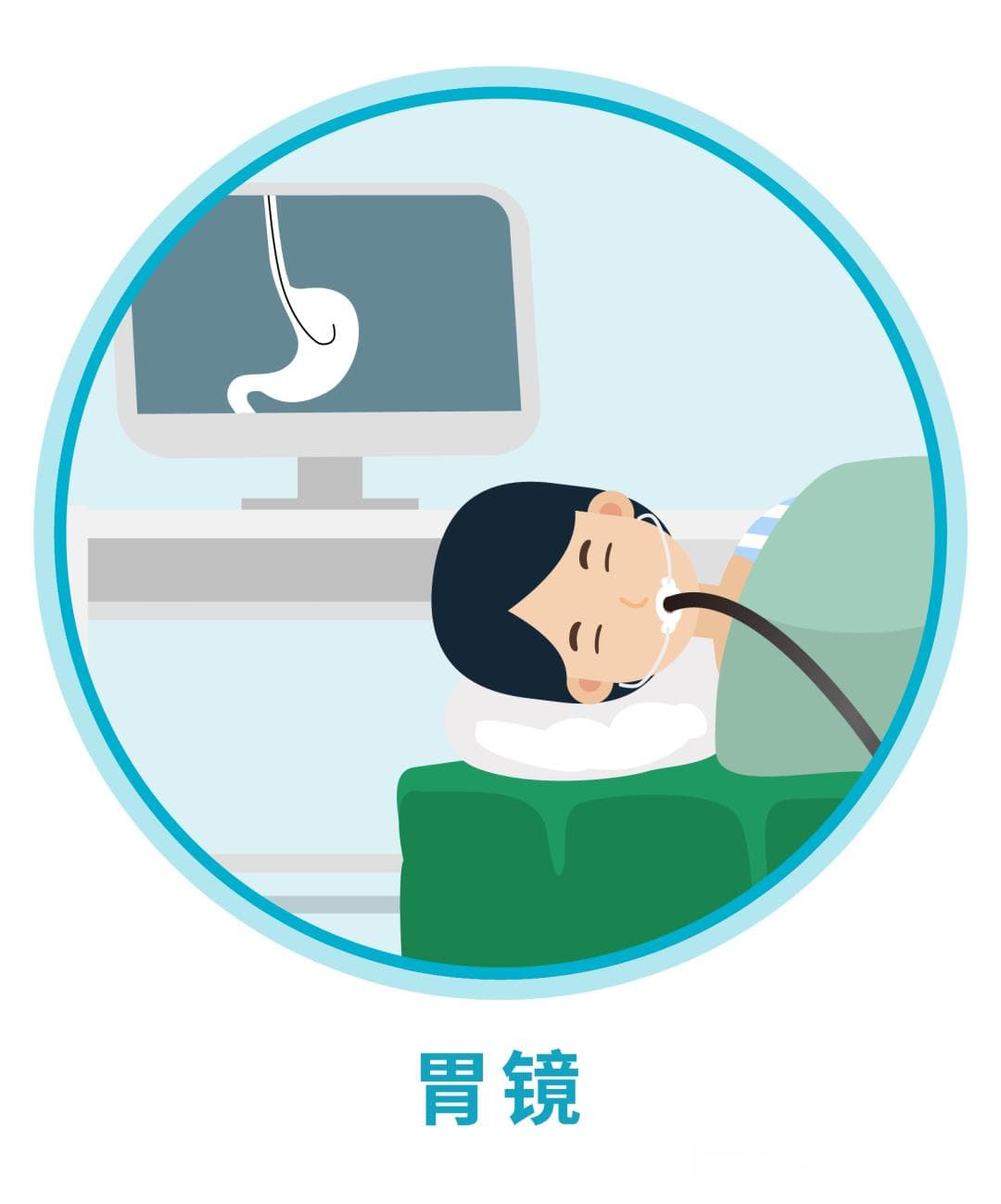 诊断胃食管反流病？这三项检查少不了！
