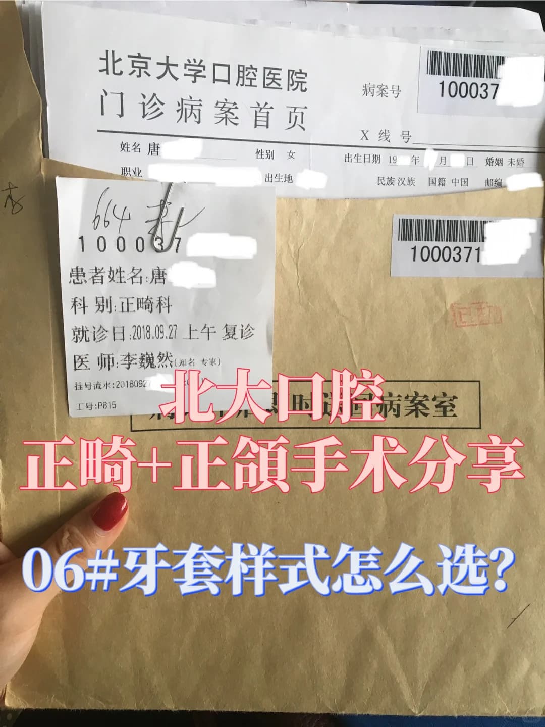 北大口腔医院牙套选择指南：从材质到功能的全面解析