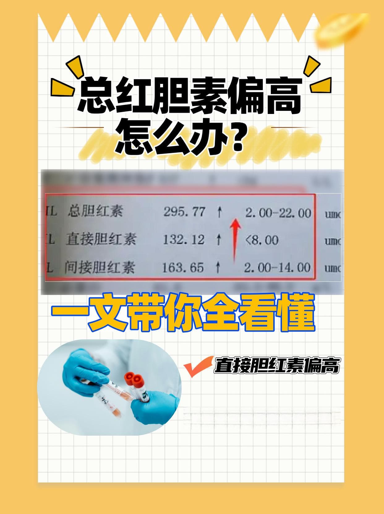 总胆红素偏高怎么办？一文带你全看懂