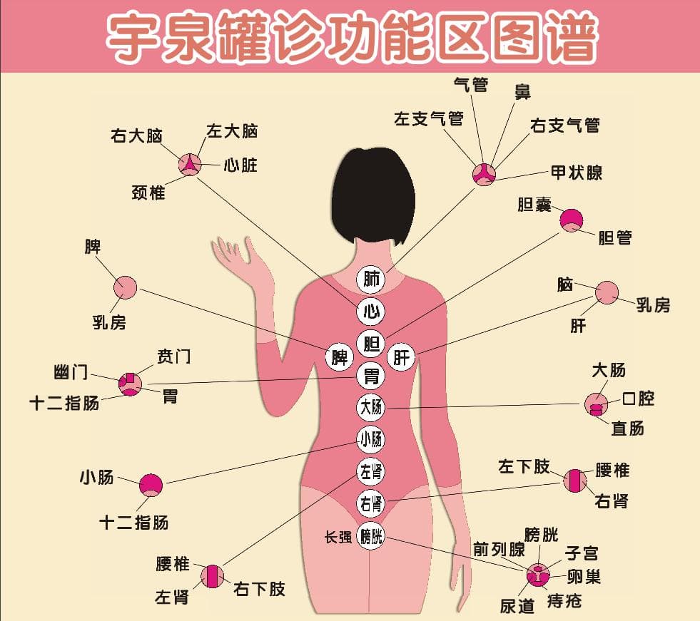 李氏脊柱拔罐诊疗法：传统中医的现代传承与创新