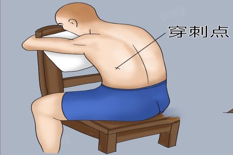 胸腔穿刺为什么选择肋骨上缘？从解剖结构到临床应用的全面解析