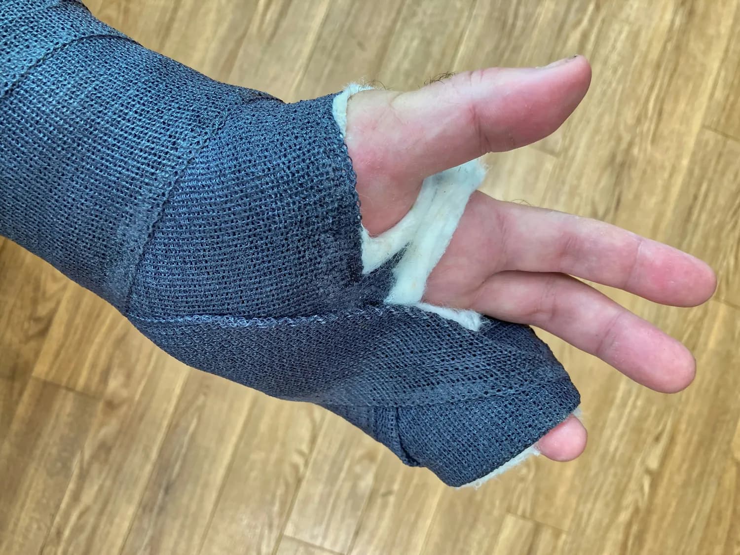 眼科专家教你正确护眼：冷敷还是热敷？