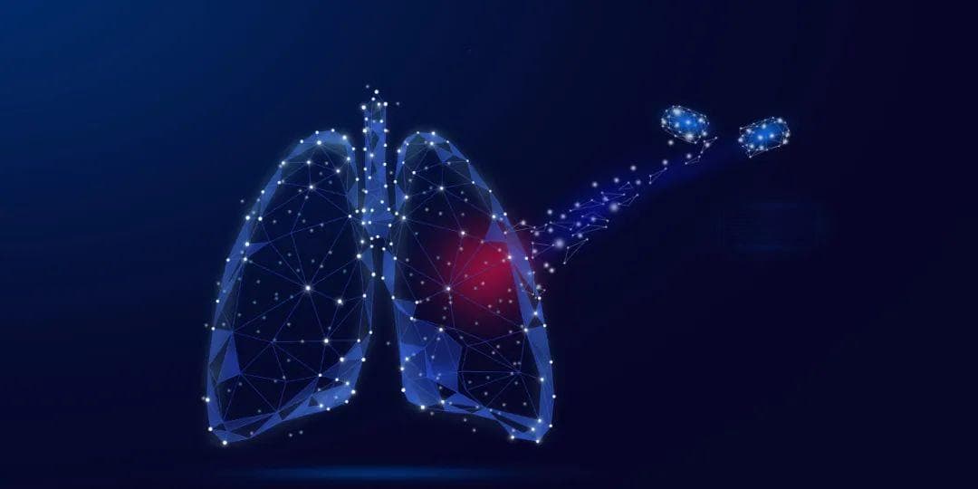 重症肺癌被逆转！来看看这个病例是怎么救治的