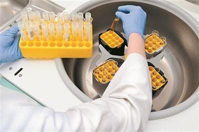 慢性肾病患者超1亿且知晓率低，专家提醒：这些症状要警惕