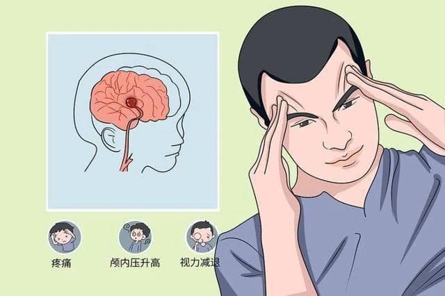 了解癫痫“小征兆”，做好识别与应对，减少不必要伤害