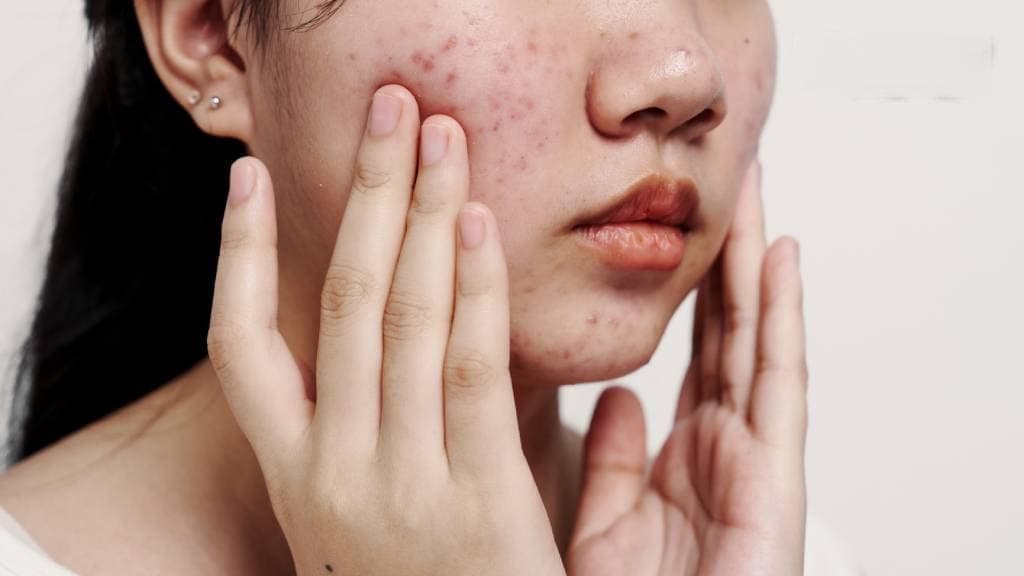 皮膚不好怎麼辦？中醫揭密3大調理對策 多吃2類食物助改善