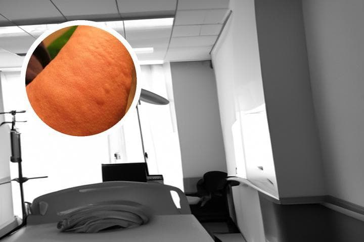 荨麻疹是什么造成的？全面解析荨麻疹的成因、类型、诊断与治疗