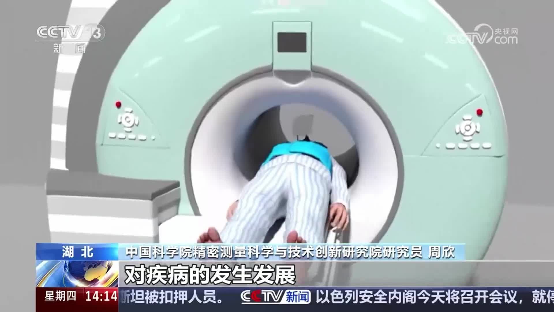 我国磁共振成像技术获新突破 | 科技推动力 抢占科技制高点