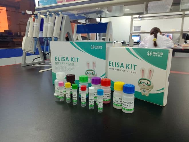 双链 DNA 抗体与自身免疫性疾病的关联