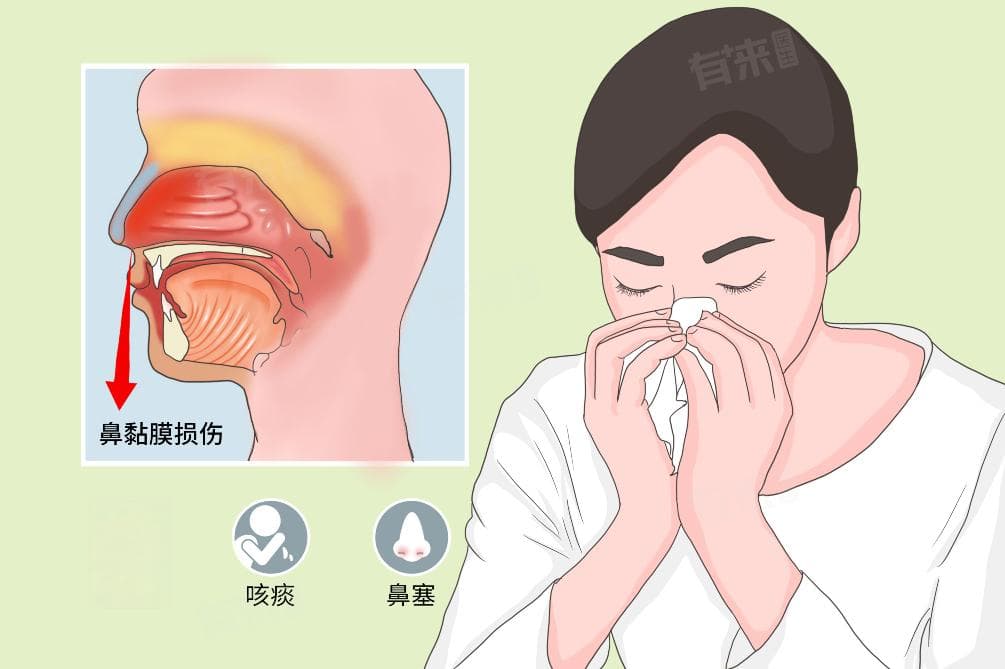 鼻后滴漏的症状及日常注意事项
