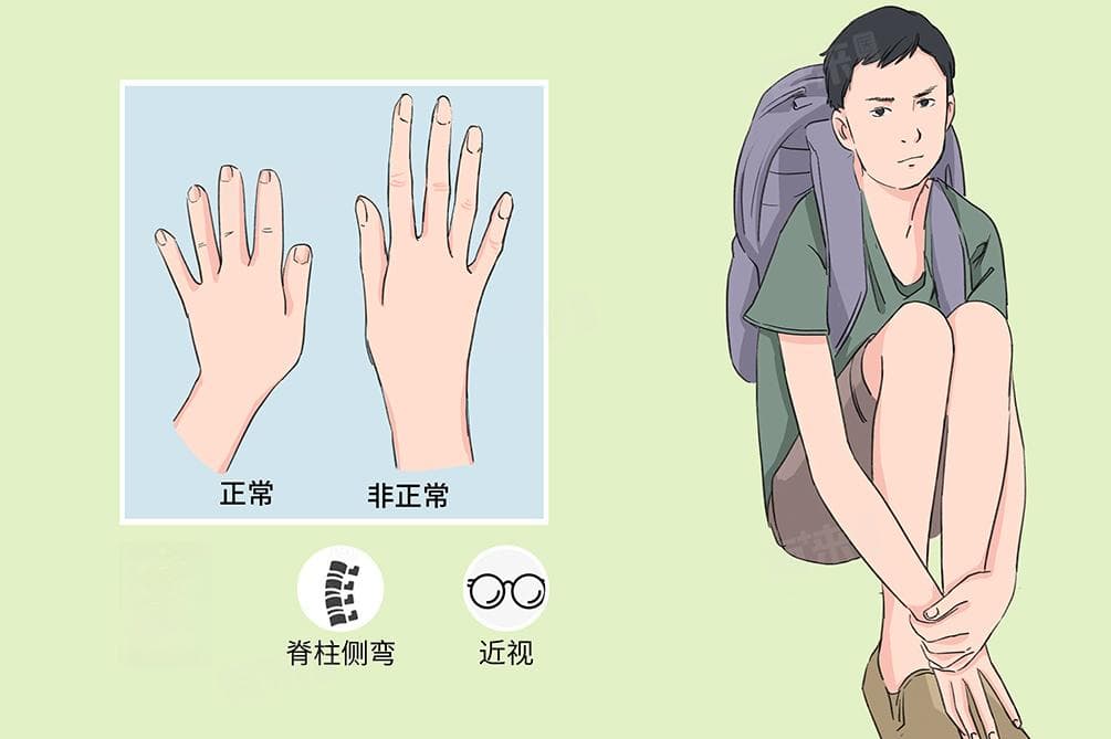 马凡综合征是什么？这种遗传病有哪些症状和注意事项？