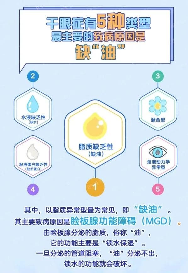 干眼症原来缺的是油不是水！得了干眼症怎么办？