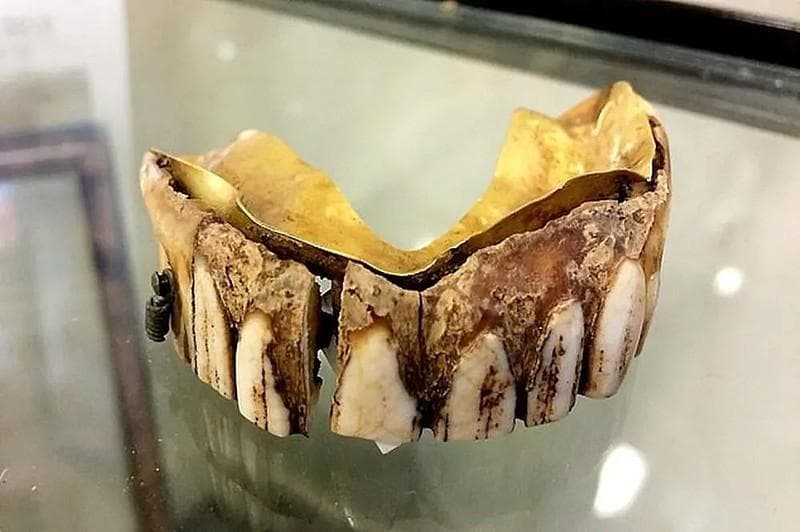 4500年的假牙进化史正在被AI改变