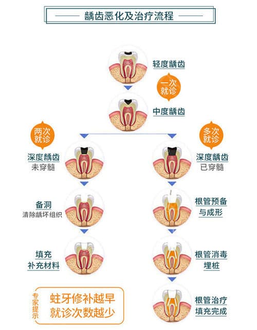 龋齿预防与治疗全攻略：从成因到治疗，让你远离蛀牙烦恼
